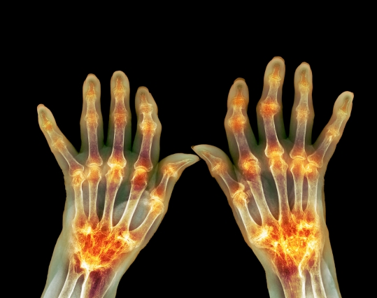 Illustration of x-ray hands